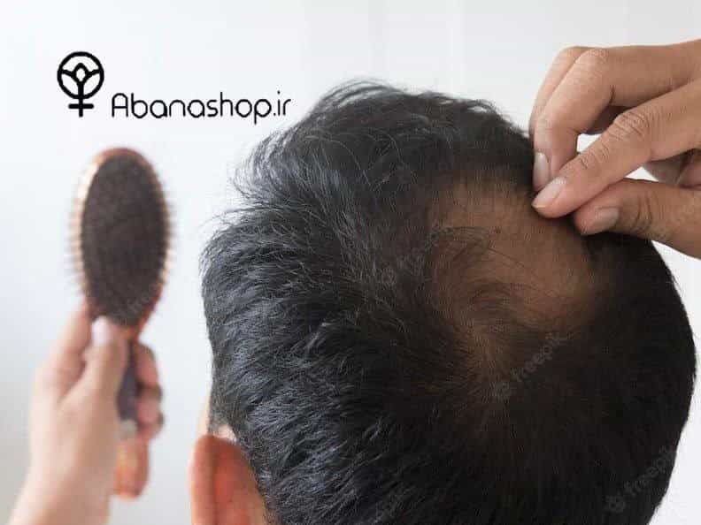 علت ریزش مو چیست؟ روش های موثر در درمان ریزش مو